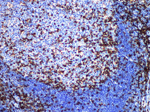 CD43 Monoclonal Antibody (ELAB6016-M)