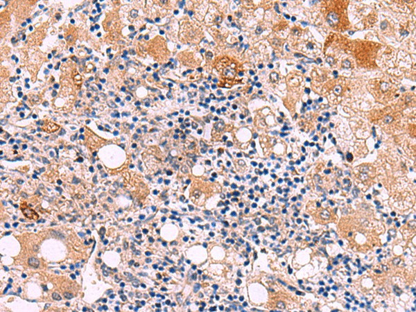 KATNAL1 Polyclonal Antibody (E-AB-52974)