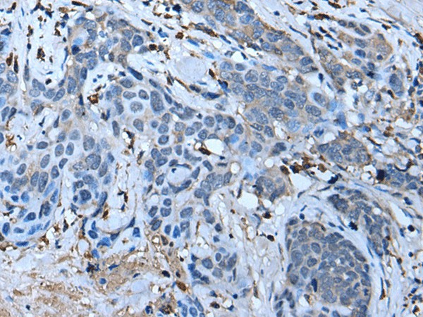 F3 Polyclonal Antibody (E-AB-53340)