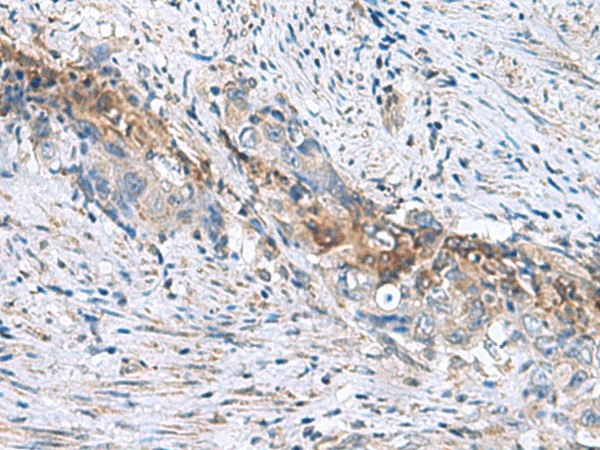 RNF208 Polyclonal Antibody (E-AB-53066)