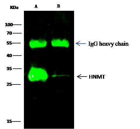 Recombinant HNMT Monoclonal Antibody (AN300161P)