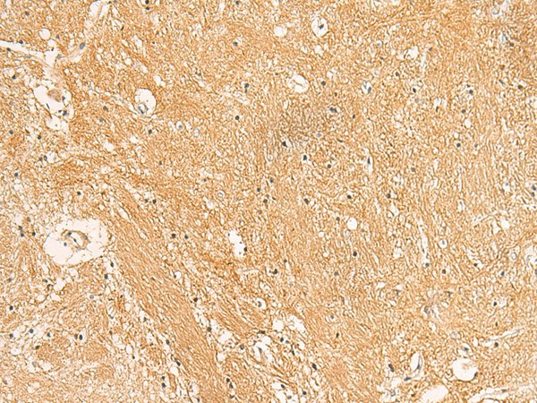 TXNDC12 Polyclonal Antibody (E-AB-52826)