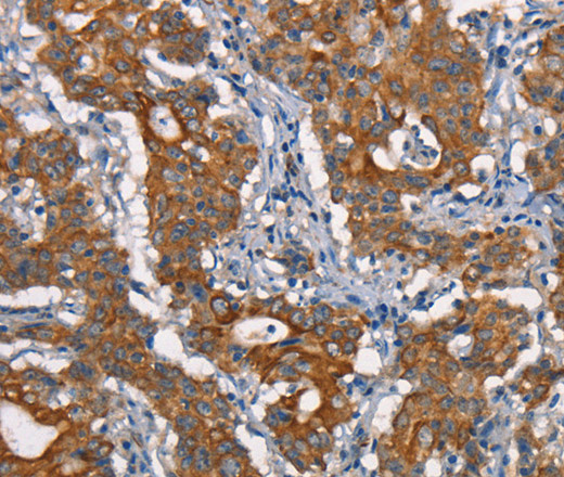 CDC23 Polyclonal Antibody (E-AB-15982)