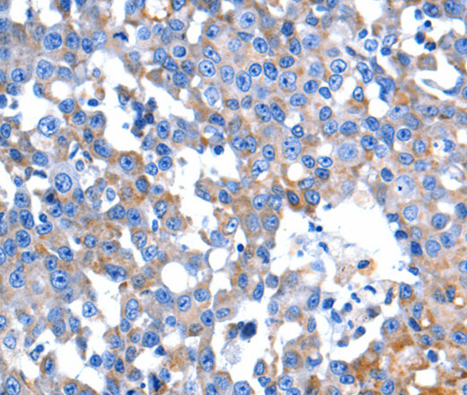 HINT2 Polyclonal Antibody (E-AB-15710)