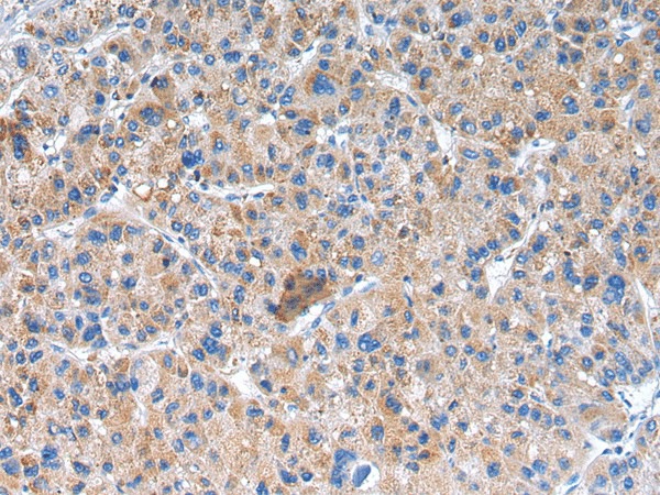 GLRA1 Polyclonal Antibody (E-AB-17324)