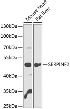 SERPINF2 Polyclonal Antibody (E-AB-90725)