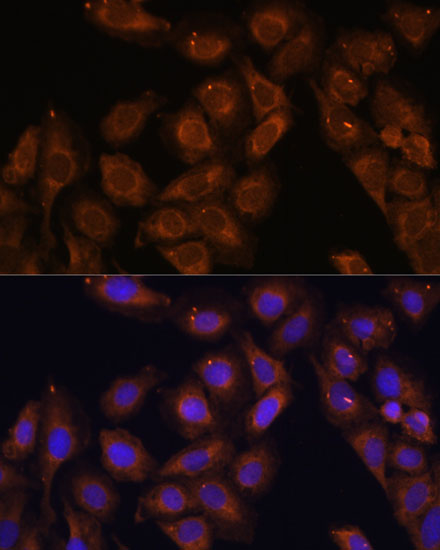UPF1 Polyclonal Antibody (E-AB-60326)