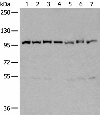 VCP Polyclonal Antibody (E-AB-18489)