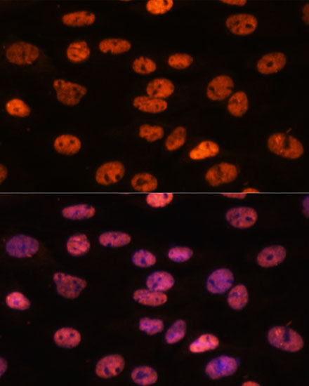 MYEF2 Polyclonal Antibody (E-AB-66598)