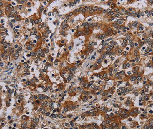 NLRP9 Polyclonal Antibody (E-AB-13460)