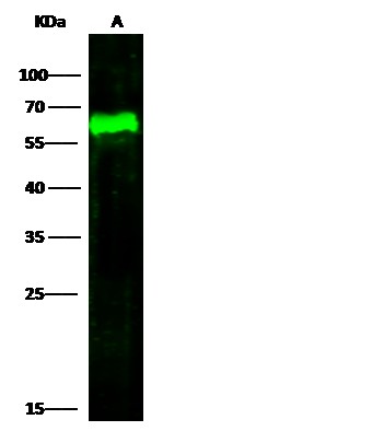 Recombinant Arylsulfatase A/ARSA Monoclonal Antibody (AN300107P)