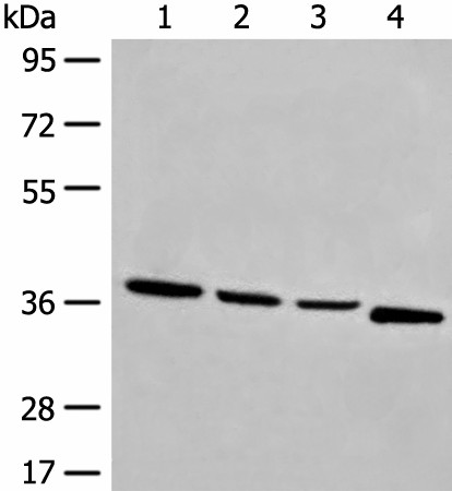 OTUD6A Polyclonal Antibody (E-AB-17894)