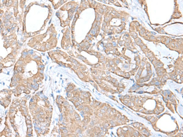 C9orf116 Polyclonal Antibody (E-AB-18760)