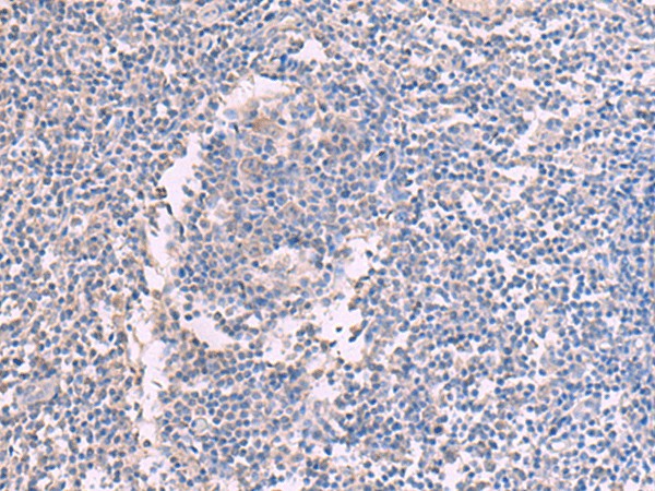 CCT5 Polyclonal Antibody (E-AB-52986)
