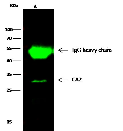Recombinant Carbonic Anhydrase II/CA2 Monoclonal Antibody (AN300190P)