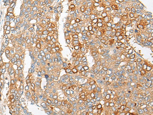 PCDHGB5 Polyclonal Antibody (E-AB-19758)
