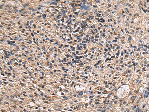 ITIH2 Polyclonal Antibody (E-AB-53189)