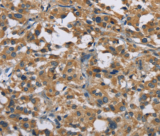 GAB1 Polyclonal Antibody (E-AB-14619)