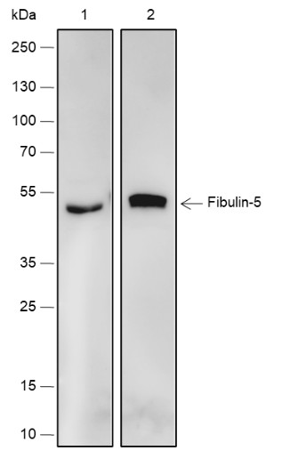 Recombinant Fibulin-5 Monoclonal Antibody (AN301854L)
