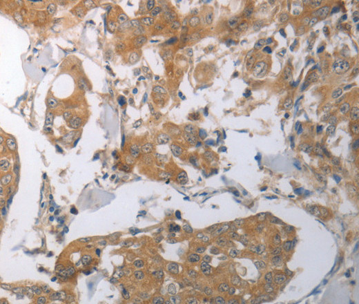 SHH Polyclonal Antibody (E-AB-12636)