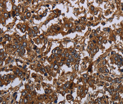 HOMER2 Polyclonal Antibody (E-AB-15099)
