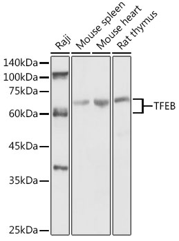 TFEB Polyclonal Antibody (E-AB-93321)