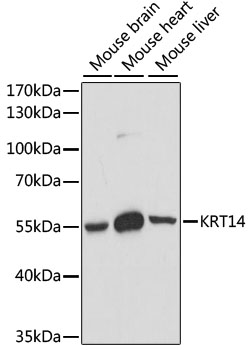 KRT14 Polyclonal Antibody (E-AB-65187)