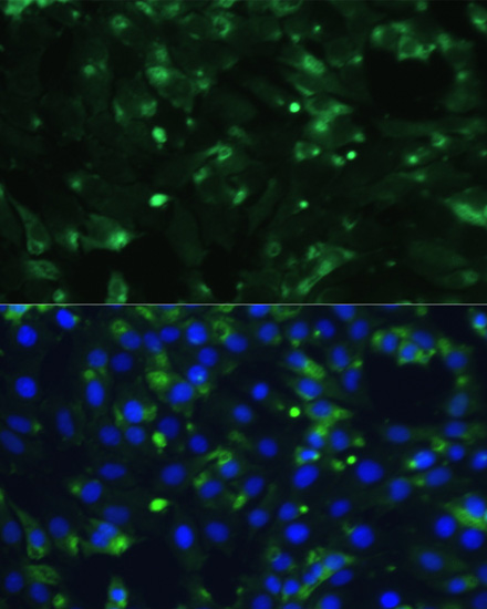 ENO1 Polyclonal Antibody (E-AB-66959)