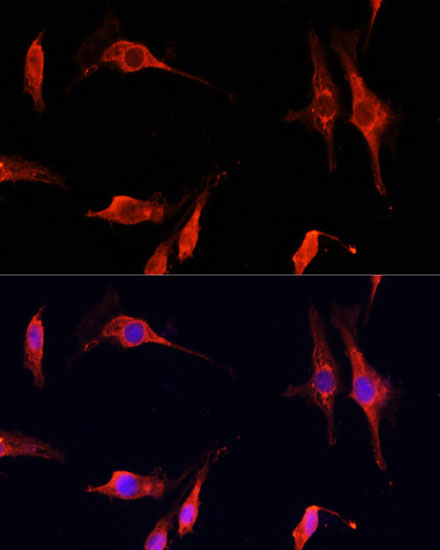 DNASE1 Polyclonal Antibody (E-AB-66303)