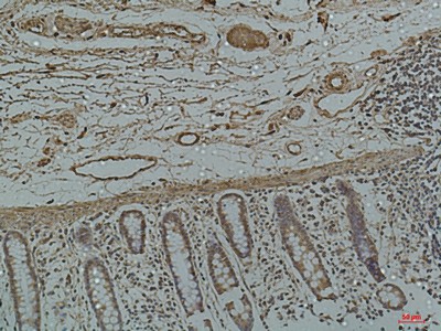 Galectin 3 Monoclonal Antibody (E-AB-22185)