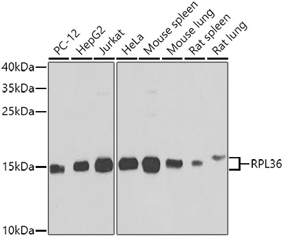 RPL36 Polyclonal Antibody (E-AB-62405)
