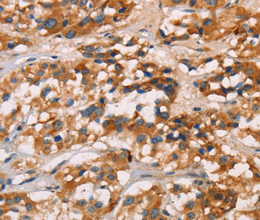 CD80 Polyclonal Antibody (E-AB-13083)
