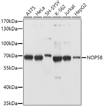 NOP58 Polyclonal Antibody (E-AB-62449)