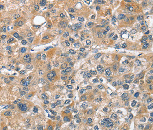 CHMP4B Polyclonal Antibody (E-AB-14871)