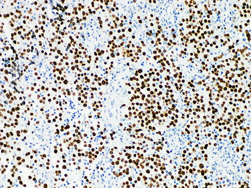 SALL4 Monoclonal Antibody (ELAB6681-M)