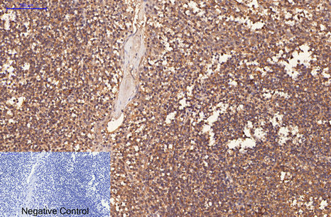 CD1A Monoclonal Antibody (E-AB-22096)