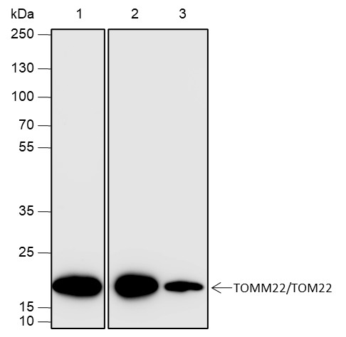 Recombinant TOMM22/TOM22 Monoclonal Antibody (AN301949L)