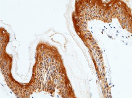 Recombinant IL20RA/IL-20RA Monoclonal Antibody (AN300332P)