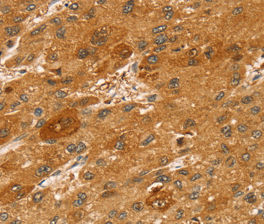 STX2 Polyclonal Antibody (E-AB-13711)