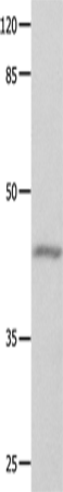 GNA11 Polyclonal Antibody (E-AB-10328)