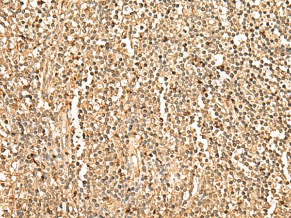 PPM1G Polyclonal Antibody (E-AB-52759)
