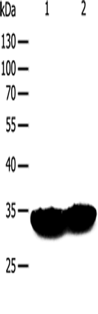 TPM1 Polyclonal Antibody (E-AB-10661)