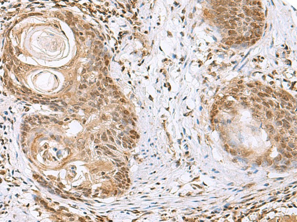 ELAC1 Polyclonal Antibody (E-AB-18999)
