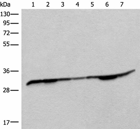RSU1 Polyclonal Antibody (E-AB-18667)
