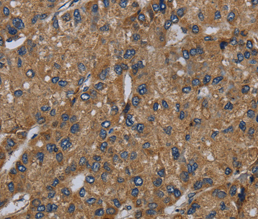 NDUFS6 Polyclonal Antibody (E-AB-15246)