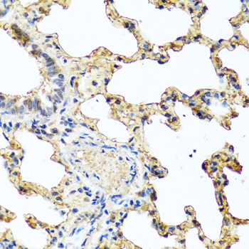 PIP Polyclonal Antibody (E-AB-61929)