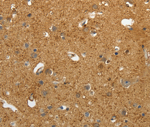 AKAP12 Polyclonal Antibody (E-AB-12884)