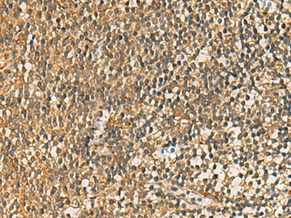 FAAP100 Polyclonal Antibody (E-AB-17975)