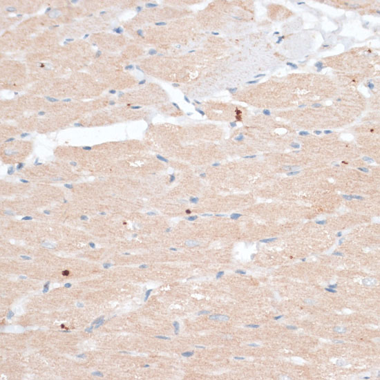 ABCB7 Polyclonal Antibody (E-AB-65075)