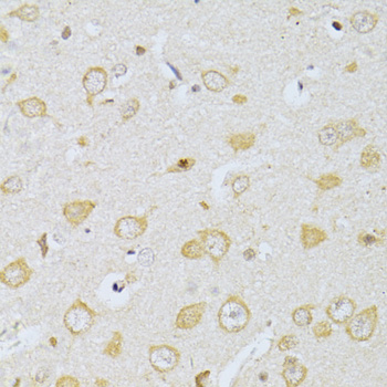 CHRNA7 Polyclonal Antibody (E-AB-62041)